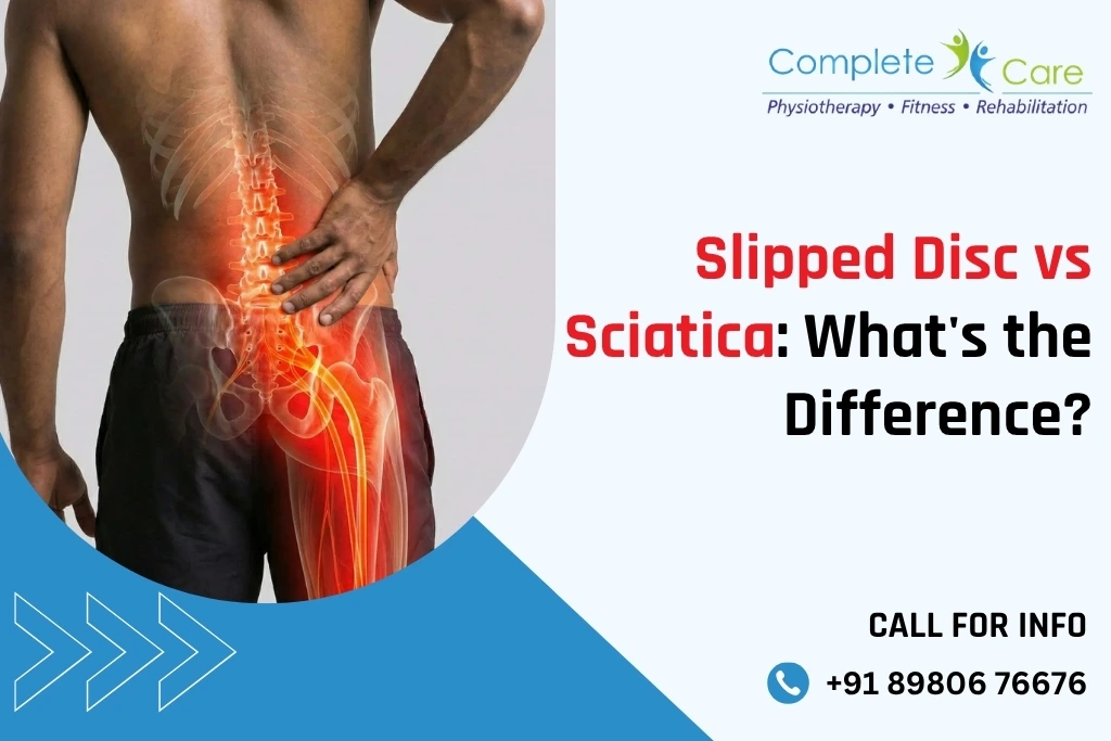 Slipped Disc vs Sciatica: What's the Difference?