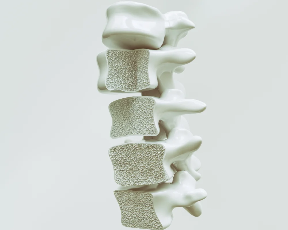 Osteoporosis-image